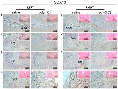 Poly(I:C) Challenge Alters Brain Expression of Oligodendroglia-Related Genes of Adult Progeny in a Mouse Model of Maternal Immune Activation